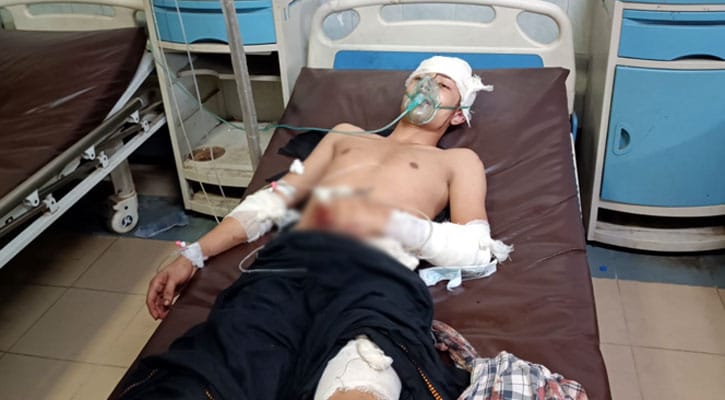 স্বেচ্ছাসেবক লীগ নেতার ভা‌তিজাকে কুপিয়ে আহত করেছে দুর্বৃত্তরা