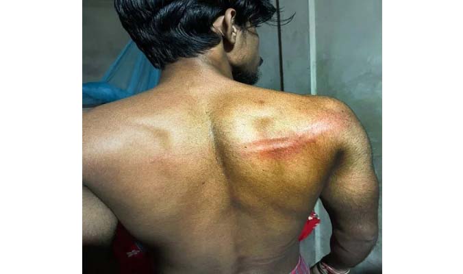 হবিগঞ্জে সেনা-পুলিশের হাতে পরীক্ষার্থী নির্যাতনের অভিযোগ
