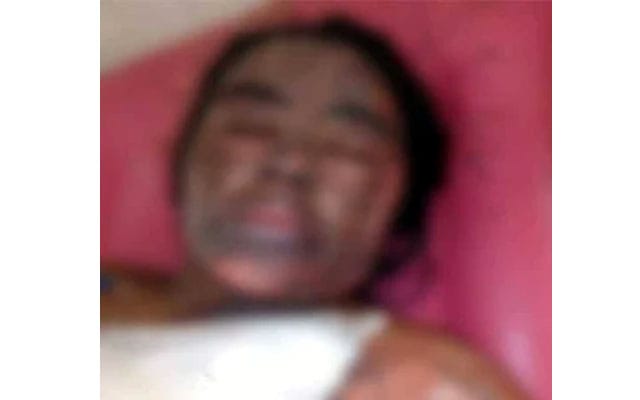 সিলেটে গর্ভবতী স্ত্রীকে পুড়িয়ে মারার চেষ্টা, সন্তানের মৃত্যু